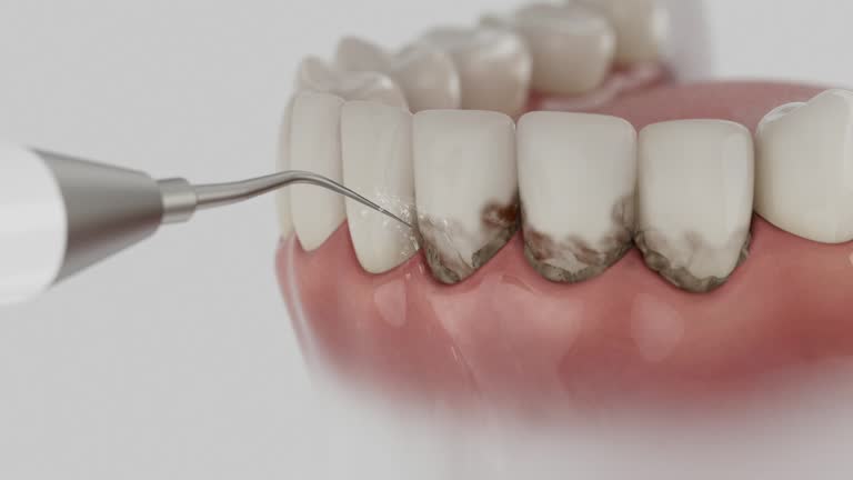 Reliable Teeth Cleaning And Checkup contractor in Heard County County, GA by Dentist Open Now